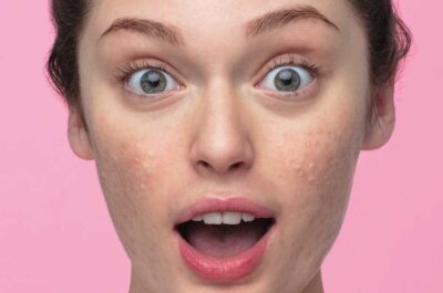 svr dermatologie